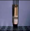 Ficol-hypaque lymphocyte separation