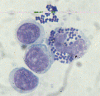 PMN with S. aureus